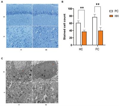 Brain-aging related protein expression and imaging characteristics of mice exposed to chronic hypoxia at high altitude